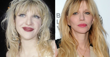 Celebrity plastic surgery: Before and after photos