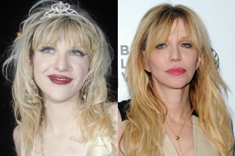 Celebrity plastic surgery: Before and after photos